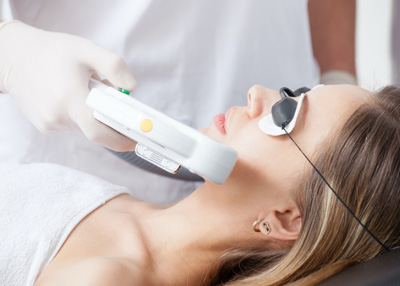 Rejuvenecimiento Facial con Laser CO2 Fraccionado